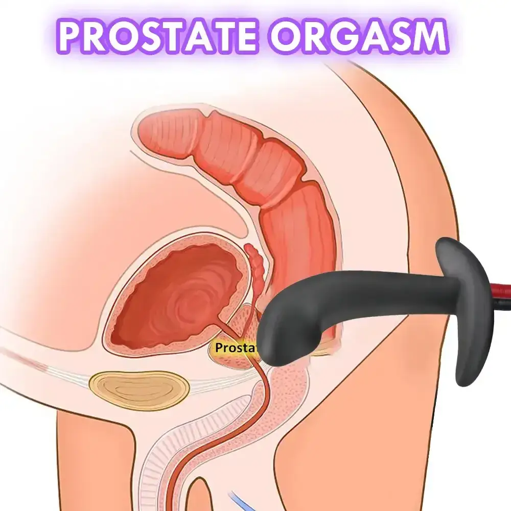 plug anal electrique pour homme stimulation