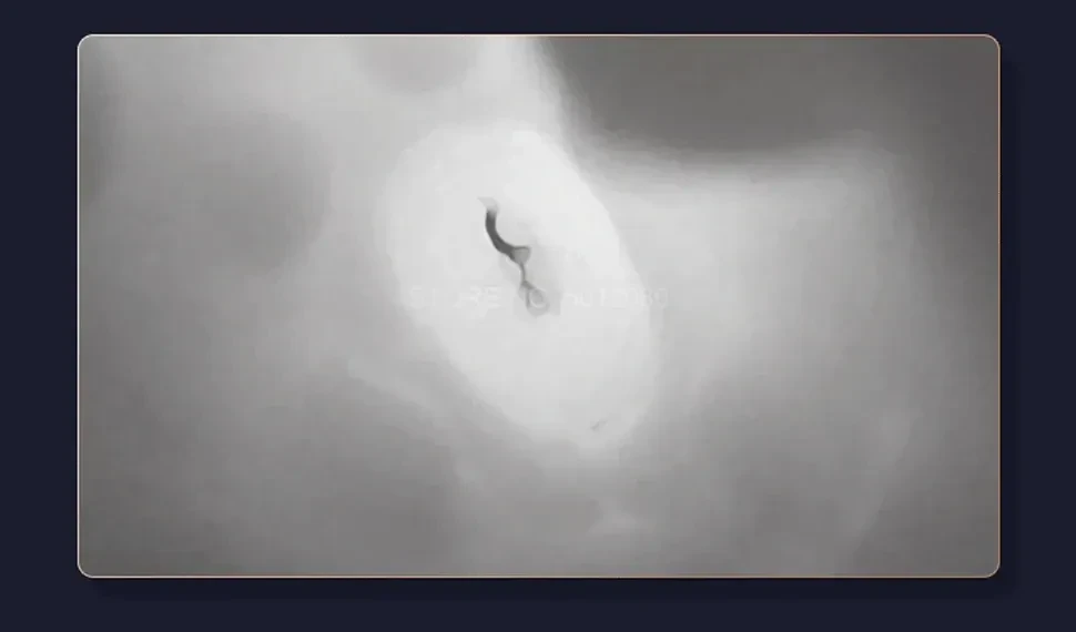 sleeve masturbatoire vibrant aspiration forte